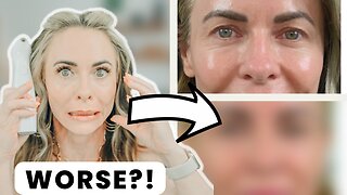 NIRA Skincare Laser | Does the Before & After Make Eyes Look Worse