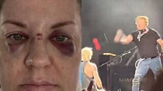 Woman Says Axl Rose Hit Her With Microphone During Guns N' Roses Show