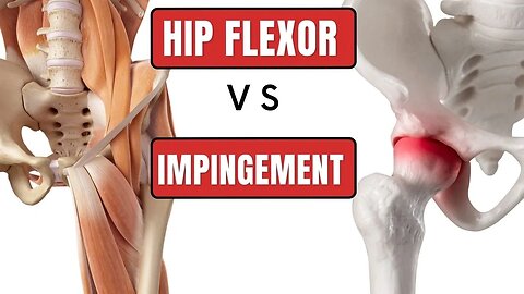 Femoroacetabular Impingement Hip (FAI) vs Hip Flexor Strain - Self Tests