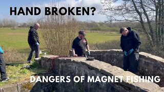Dangers of Magnet Fishing, Hand Broken?