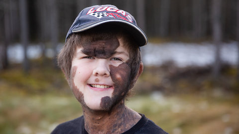 Boy With Giant Mole Beats The Bullies | BORN DIFFERENT