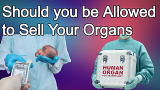 Should You be Allowed to Sell Your Organs?