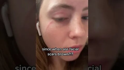 Since When Are Facial Scars Brown?!? Video By Glizzylizzie02 #Shorts