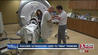 Focused ultrasound used to treat tremors