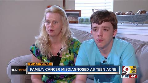 Family: Teen's cancer misdiagnosed as acne