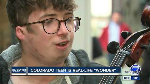 Westminster teen shares same syndrome as boy from 'Wonder' film