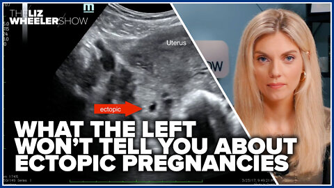 What the Left won’t tell you about ectopic pregnancies