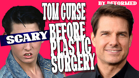 Tom Curse Before Surgery (deformed magazine)