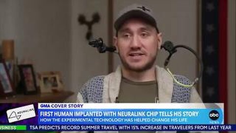 THIS PERSON IS THE FIRST HUMAN TO RECEIVE ELON MUSK'S NEURALINK BRAIN IMPLANT CHIP.