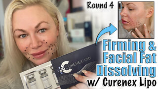 Firming and Facial Fat Dissolving with Curenex LIpo from AceCosm.com | Code Jessica10 Save you Money