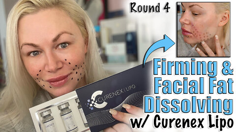 Firming and Facial Fat Dissolving with Curenex LIpo from AceCosm.com | Code Jessica10 Save you Money