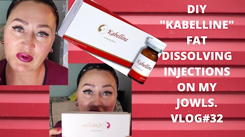 DIY KABELLINE FAT DISSOLVING INJECTIONS ON MY JOWLS. USE DISCOUNT CODE NAT10