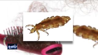 How to identify, treat, and prevent head lice