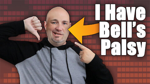 Health Update - I have Bells Palsy - What It Is & My Recovery Plans