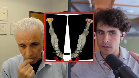 How to Protect TMJs During Skeletal Expansion of Mandible