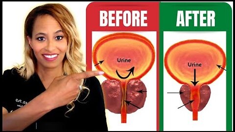 The #1 Important All-Natural Way to Shrink the Prostate Dr Rachael