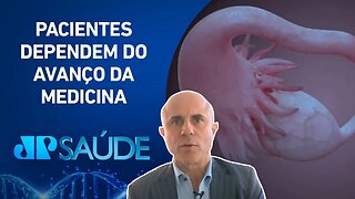 “Câncer de ovário é o tumor feminino mais perigoso”, diz especialista | Dr. Fernando Maluf