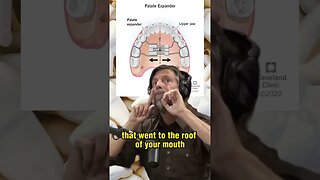 The Revolutionary Orthodontic Device That Expands Your Mouth and Improves Breathing - Joe Rogan