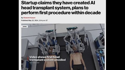 The Fallen Ones Technology! Company Announces Plans To Do Human Head Transplants!