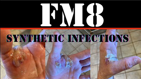 FM8 - POSSIBLE SYNTHETIC INFECTION