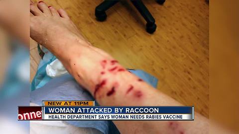 Raccoon attack leaves Hillsborough County woman in need of stitches, rabies treatment