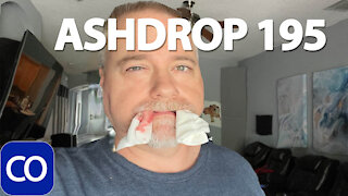 Wisdom Teeth Removal Update And Ashdrop 195