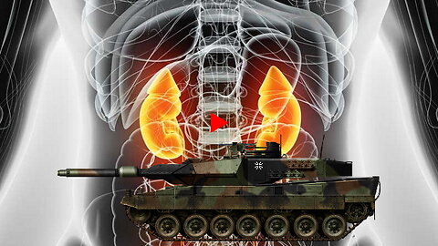 UKRAINE - Tanks for Kidneys