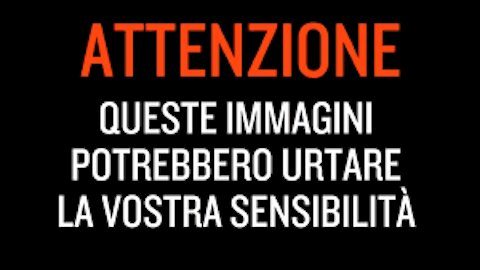 Attenzione⚠️ Questo video non è per i deboli di cuore😱 Estrazione di coagulo di sangue dal naso