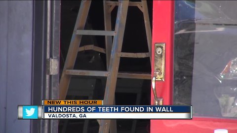 Hundreds of teeth found inside wall