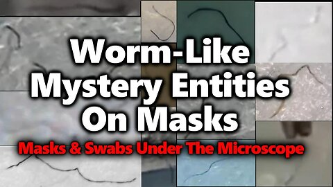 Moving Black Strings On Masks & Swabs： Parasites？ Morgellons？ Worm-Like Micelles For Drug