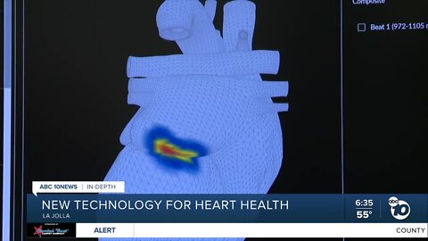 UC San Diego doctor creates new way to diagnose irregular heartbeat
