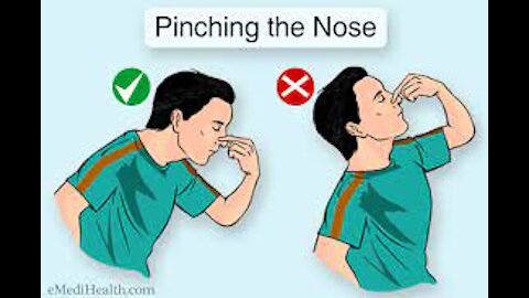 How To Treat Nose Bleeds With Natural Home Remedies in 7 Natural Remedies For Nose Bleeding