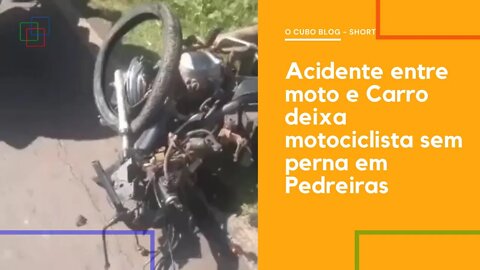 Acidente entre moto e Carro deixa motociclista sem perna em Pedreiras