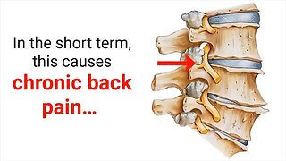 End Back Pain Now: The Back Pain Breakthrough You've Been Waiting For