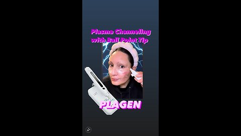 Plasma Channeling using Plagen Plasma Pen with MediCube Skincare