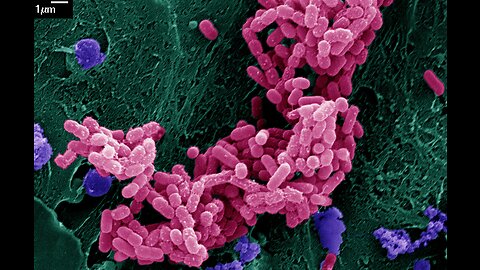 E. coli bacteria instrumental in the "vaccine" production process, loads of DNA refuse in the vials