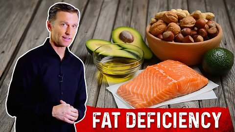 The Danger Of NOT Absorbing Fats – Dr.Berg