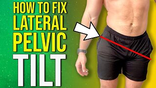 How to Fix Uneven Hips | Lateral Pelvic Tilt Correction Exercises