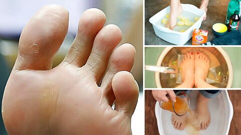 How to Get Rid of Smelly Feet for Good!