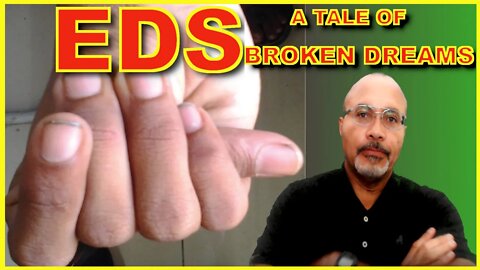Ehlers-Danlos Syndrome (EDS) (A Tale Of Broken Dreams)