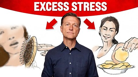 20 Signs of TOO MUCH Stress - Dr. Berg