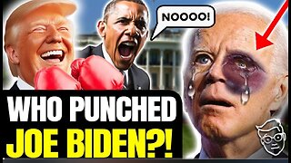 Biden Appears in Public With MASSIVE Mysterious BLACK Bruise On FACE Elder Abuse_ Another Collapse_