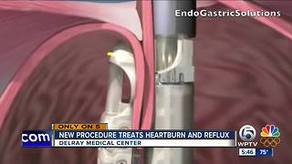 New procedure treats heartburn and reflux