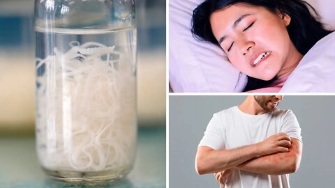 10 Signs That Someone Needs a Parasite Cleansing