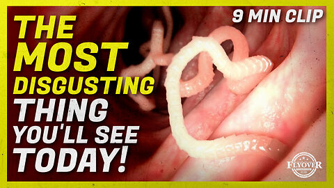 WARNING! The Most Disgusting Thing You Will See Today! - Dr. Jason Dean Clip