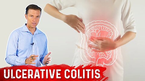 What is Ulcerative Colitis? – Causes, Symptoms & Treatment by Dr.Berg