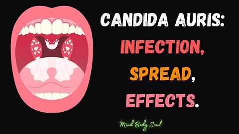 Candida Auris (Unveiling the Threat of Drug-Resistant Fungi)