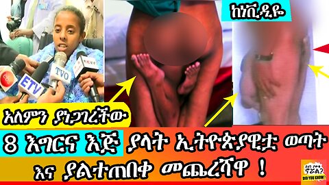 አለምን ያነጋገረችው "8 እግርና እጅ " ያላት ኢትዮጵያዊቷ ወጣት ! | ከነቪዲዬ| ethiopia | weketawi | ይህን ያውቁ ኖሯል |