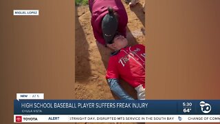 Chula Vista high school baseball player suffers freak injury