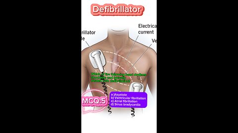 Defibrillator machine in icu #defibrillator #mcqs #pharmacologynotes #MedicalQuiz #mcqs #quiz